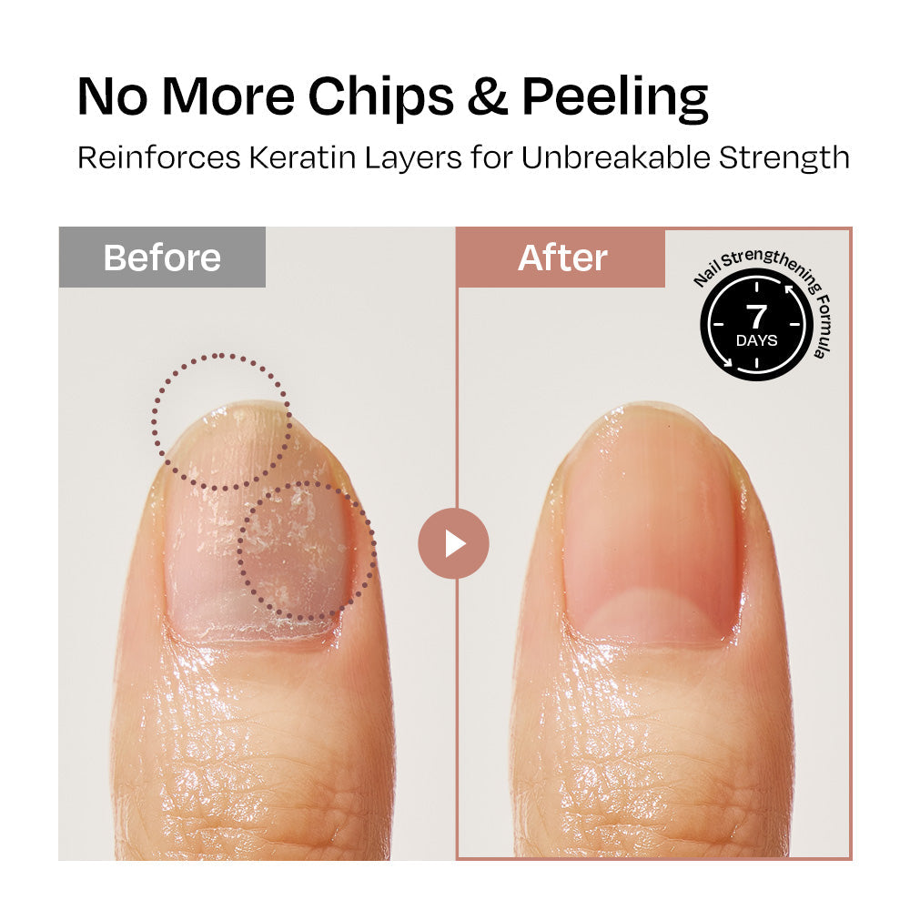 [Chai] Nail Strengthener