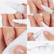 ohora Care Loose Skin Remover